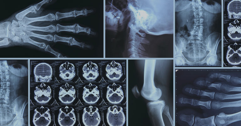 Strategies for Improving Reporting in Radiology